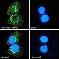 Goat anti-PI31 / PSMF1 (Isoform 1) Antibody