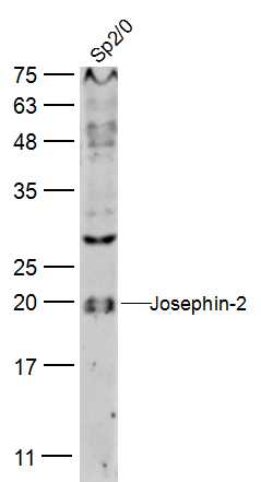 Josephin-2 antibody