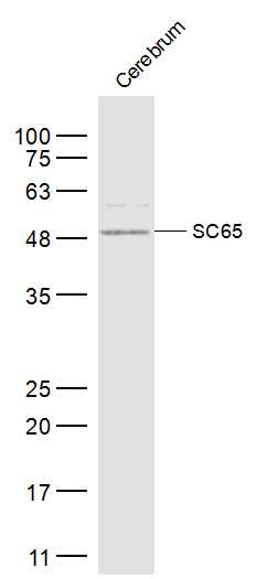 SC65 antibody