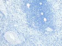 Goat anti-FLAP / ALOX5AP (C Term) Antibody