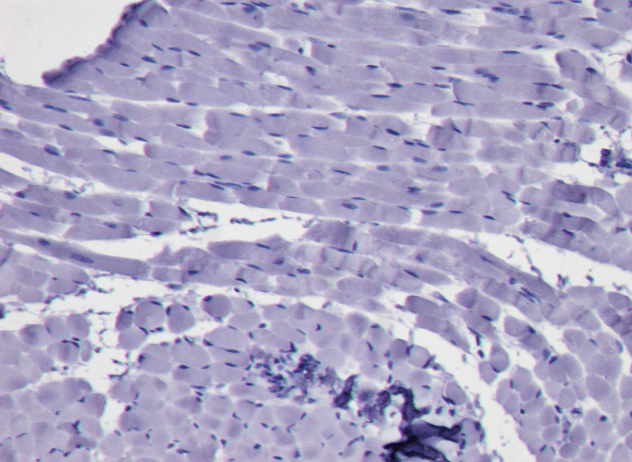 Goat anti-KLF1 / EKLF Antibody