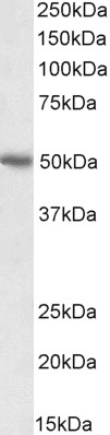 CD274 antibody