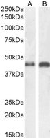 Goat anti-Arrestin beta 2 Antibody