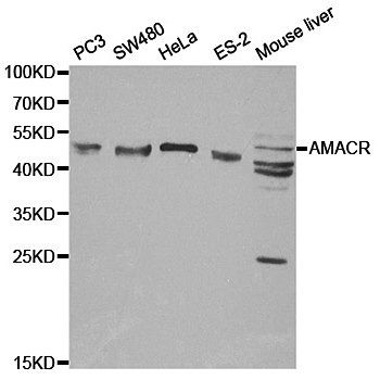 AMACR antibody