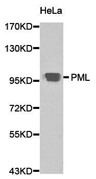 PML antibody