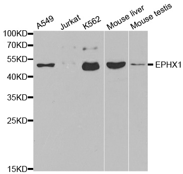 EPHX1 Antibody