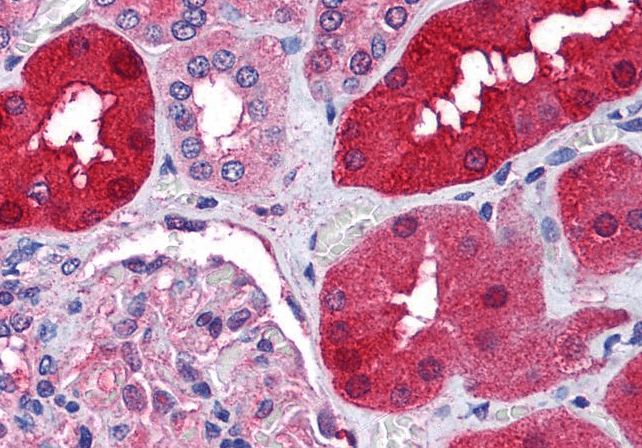 Goat anti-RNF213 / C17orf27 (internal) Antibody