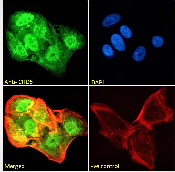Goat anti-CHD5 Antibody