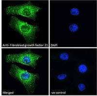 Fibroblast growth factor 21 antibody