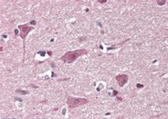 Goat anti-CHD7 Antibody