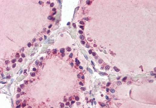 Goat anti-MAP3K7IP3 (aa 59 to 69) Antibody