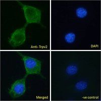 Goat anti-Trpv2 (mouse) Antibody