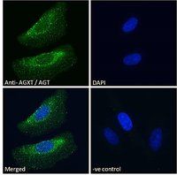 Goat anti-AGXT / AGT Antibody