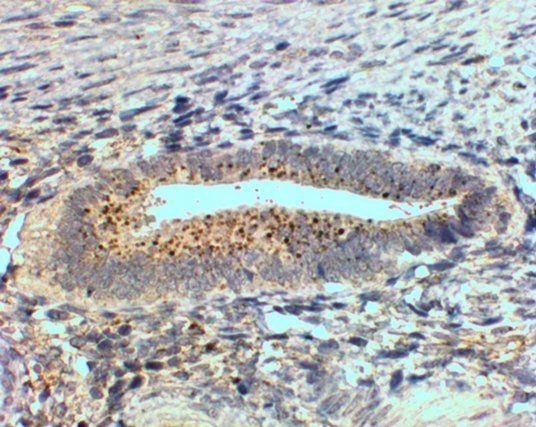 Goat anti-SFRP4 Antibody