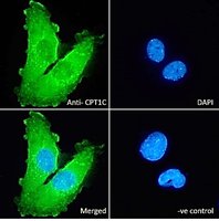 Goat anti-CPT1C Antibody