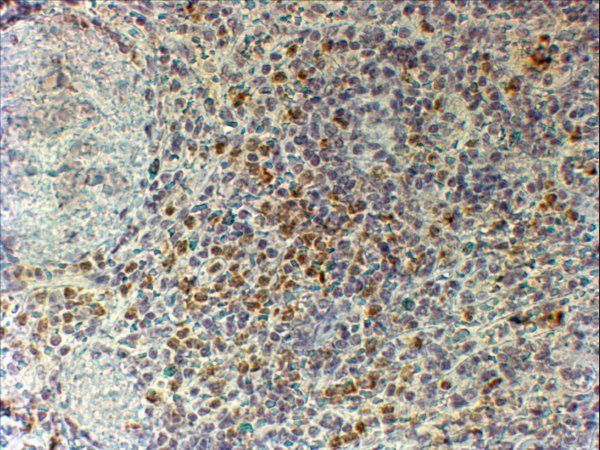 Goat anti-CYBB / GP91-PHOX Antibody