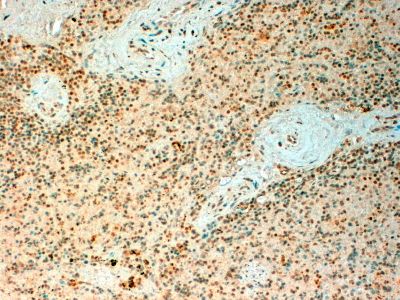 Goat anti-TET2 Antibody