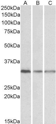 Goat anti-GNB2L1 Antibody