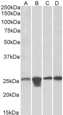 Goat anti-MNSOD (aa119-130) Antibody