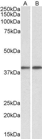 Goat anti-GNAQ / ALPHA-q (aa162-175) Antibody