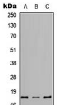 CYSLTR1 Antibody