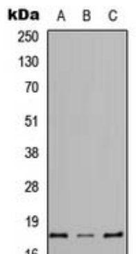 CYSLTR1 antibody