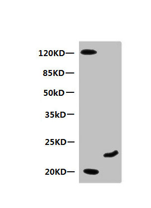 Myoglobin antibody