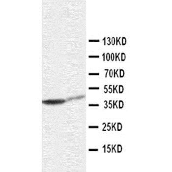 Anti-Cytokeratin 19/KRT19 Antibody