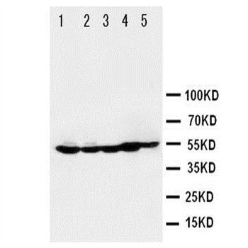 Histone deacetylase 2 HDAC2 Antibody
