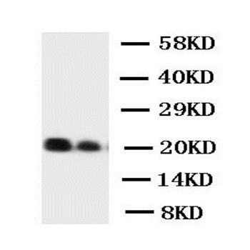 Interleukin-6 IL6 Antibody