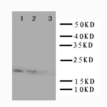 Interleukin-10 IL10 Antibody