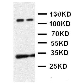 P-Cadherin-3 CDH3-Antibody