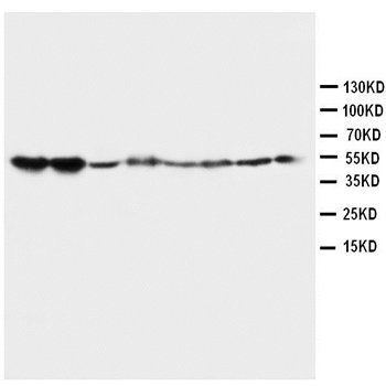 5HT2A Receptor/HTR2A Antibody