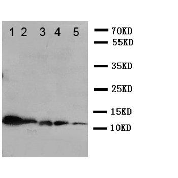 Anti-Macrophage Inflammatory Protein 1 beta/CCL4 Antibody