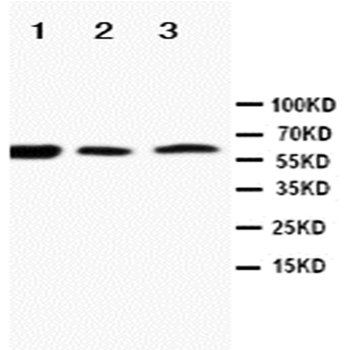 Anti-RANK/TNFRSF11A Antibody