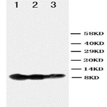 BAFF Receptor/TNFRSF13C Antibody