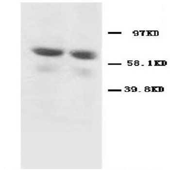 GAD65/GAD2 Antibody