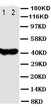 Protein NDRG1 NDRG1 Antibody