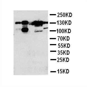 Thrombospondin 2/THBS2 Antibody