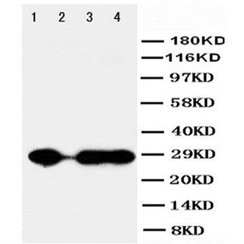 Anti-Carbonic Anhydrase I/CA1 Antibody
