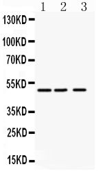 Angiopoietin-like 4/ANGPTL4 Antibody