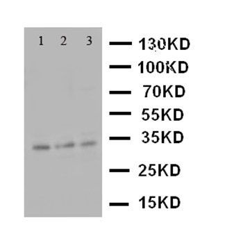 Anti-Caspase-7(P11)/CASP7 Antibody