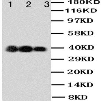 Anti-IL12 p40/IL12B Antibody