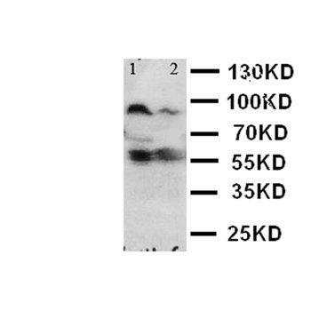 Toll-like receptor 4 TLR4 Antibody