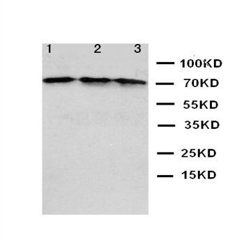 C-X-C motif chemokine 16 CXCL16 Antibody