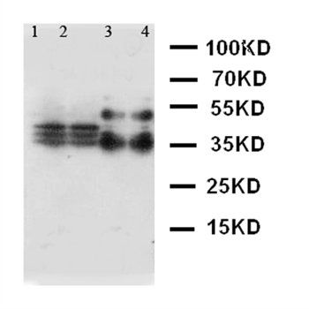 Anti-SFTPA1 Antibody