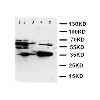 Anti-Fos B/FOSB Antibody