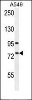 ALOX12B antibody
