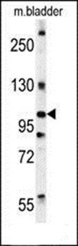 DIS3 antibody