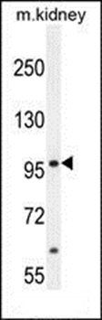 MED25 antibody